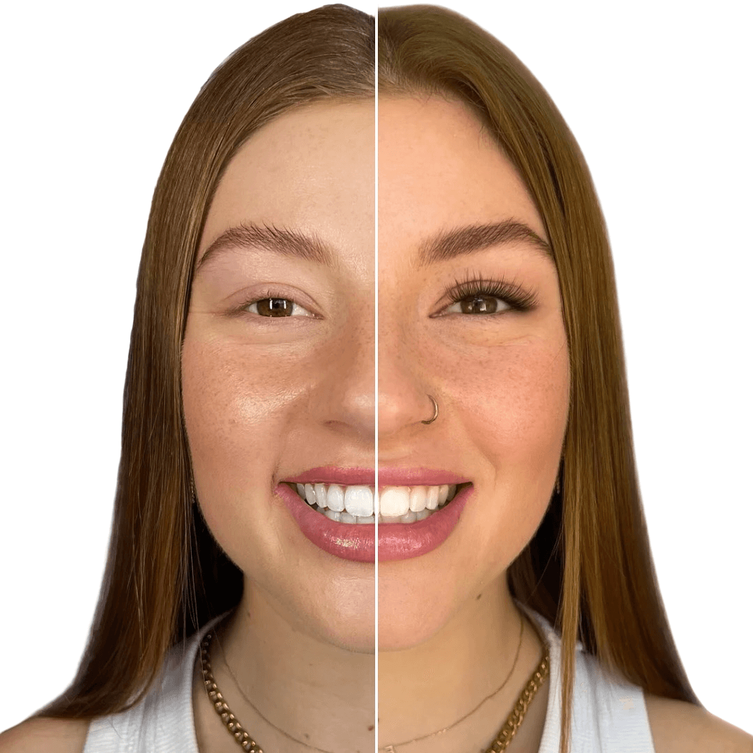 extensao de cilios em casa, Descubra cílios leves e naturalmente radiantes com o Lash Lux, que oferece durabilidade de 10 dias ou mais, sem precisar de manutenção.