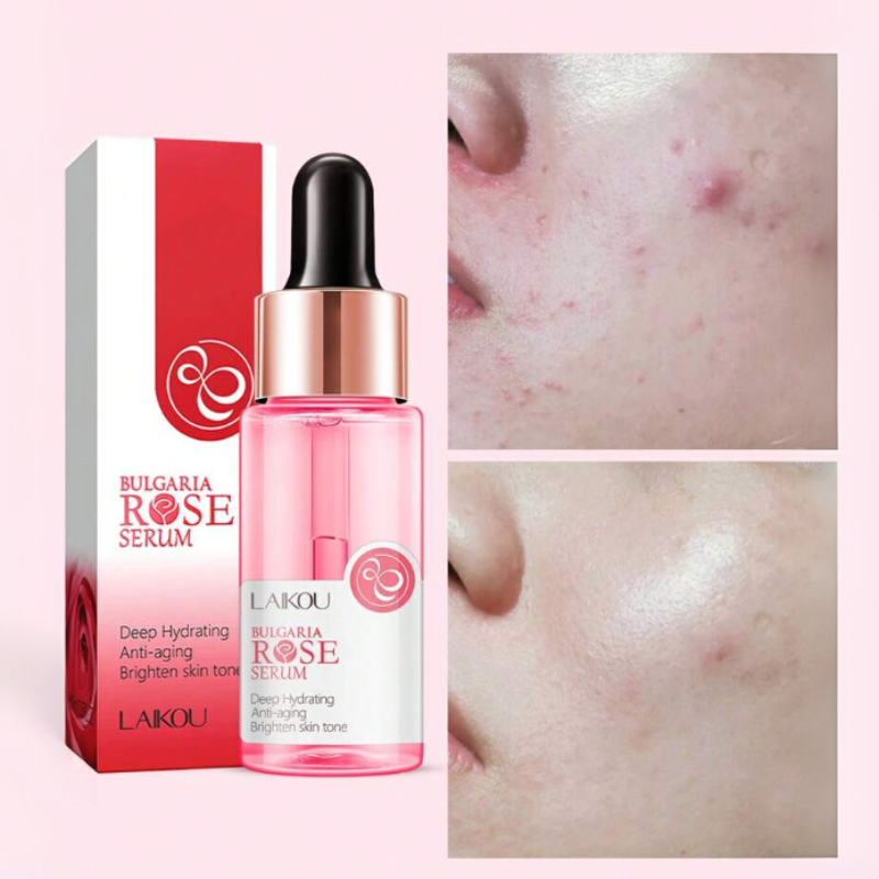 Rose Serum