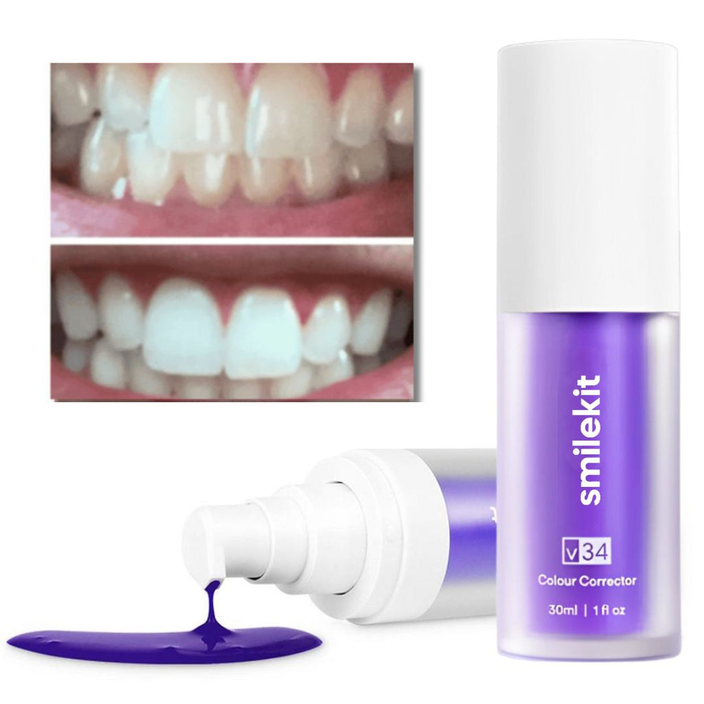 SmileKit V34 - Seus Dentes mais Brancos