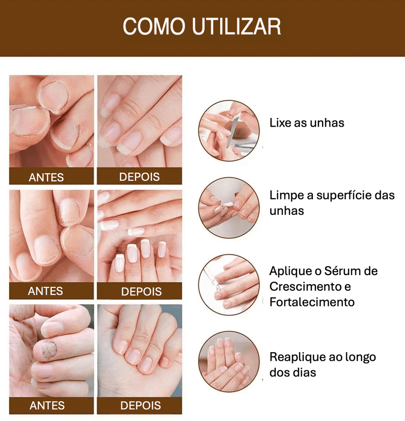 Sérum Reparador para Unhas - Fortalecimento e Estimulação do Crescimento