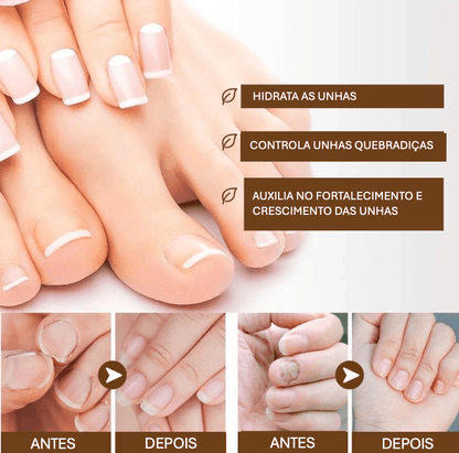 Sérum Reparador para Unhas - Fortalecimento e Estimulação do Crescimento