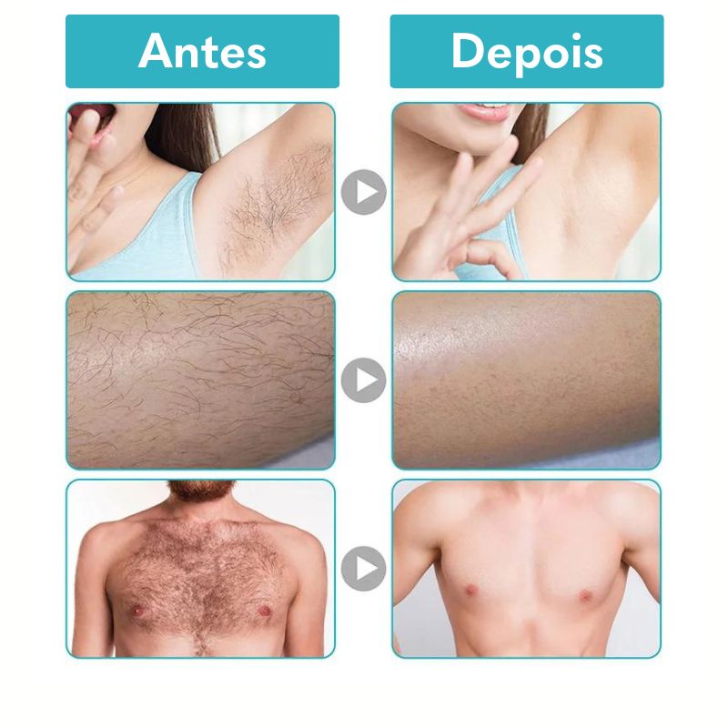 Sua solução indolor para remoção de pelos indesejáveis     O creme depilatório Depil é altamente hidratante e atua inibindo o crescimento posterior de pelos. Ele é composto por ingredientes naturais que acalmam e suavizam a pele, deixando-a lisa e macia sem qualquer desconforto.&nbsp;