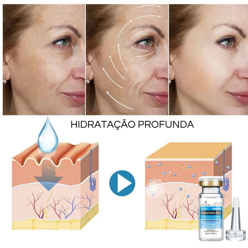 sérum, acne, cuidados com a pele, skincare, anti sinais, vitamina C, cosmético, dermocosmetico, pele bonita, estética facial, rugas, pé de galinha, linha de expressão, ácido hialurônico