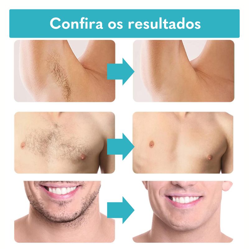 Sua solução indolor para remoção de pelos indesejáveis     O creme depilatório Depil é altamente hidratante e atua inibindo o crescimento posterior de pelos. Ele é composto por ingredientes naturais que acalmam e suavizam a pele, deixando-a lisa e macia sem qualquer desconforto.&nbsp;