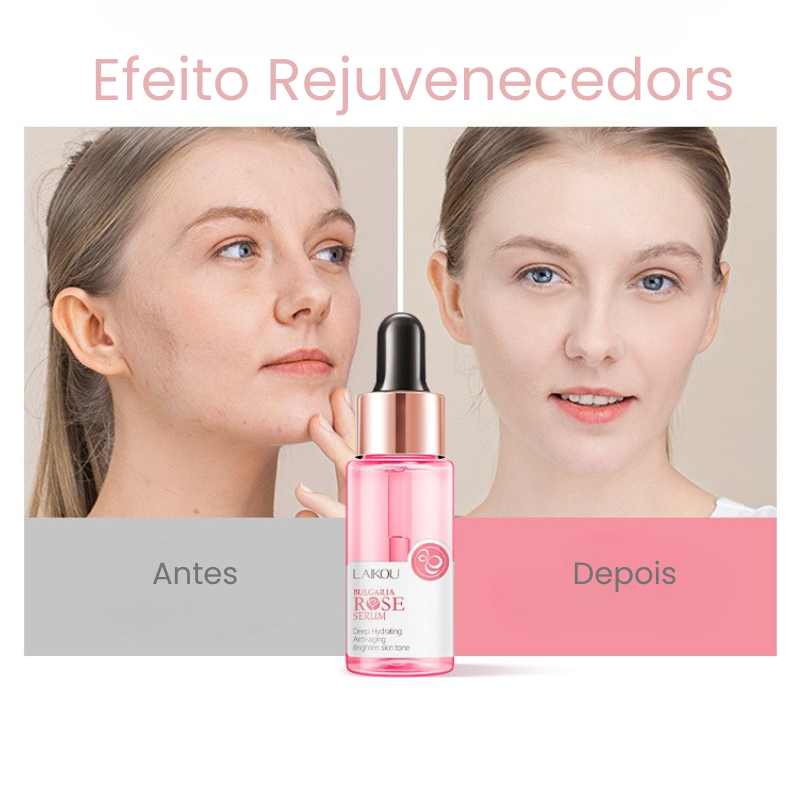 Rose Serum