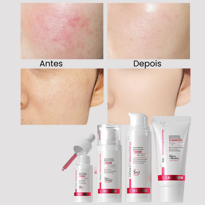 Kit para SkinCare Com Niacinamida