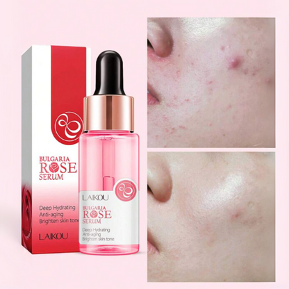 Rose Serum
